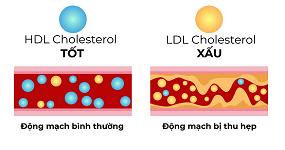 cholesterol-4